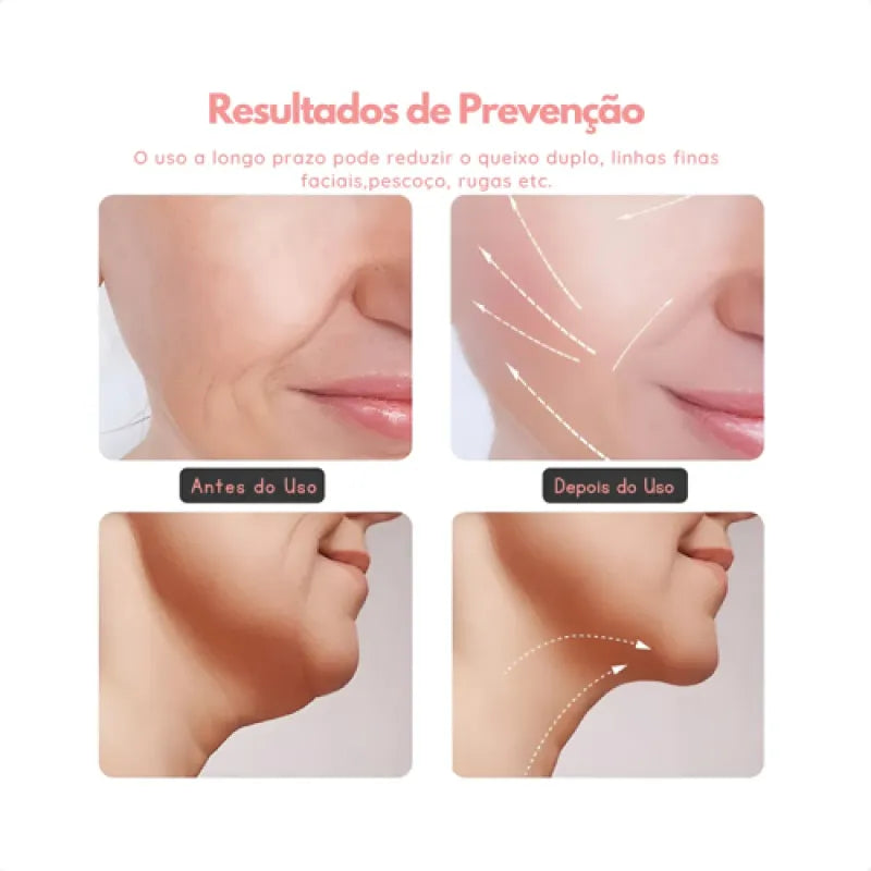 Massageador Facial Redutor de Rugas